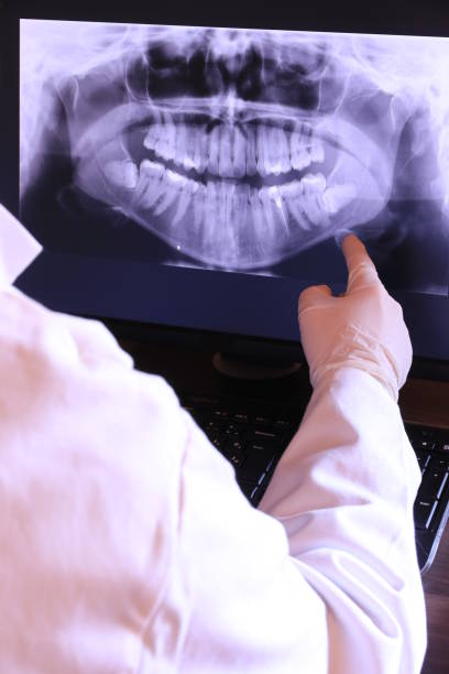 Dentist for Dental Trauma in ID
