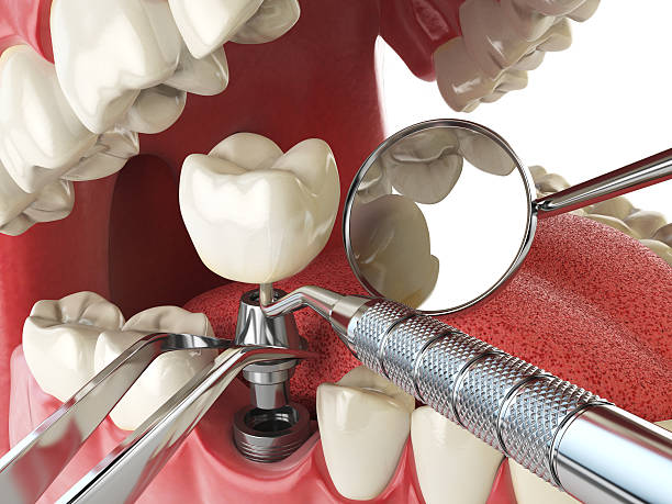 Best Emergency Tooth Extraction  in Nampa, ID